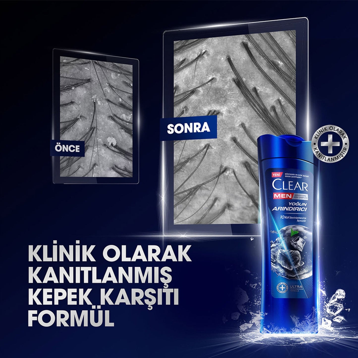 Clear Shampoo Intense Men 350Ml