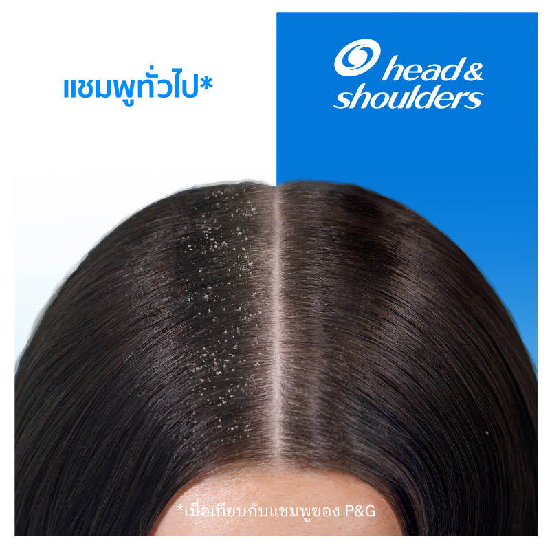 H&S Shampoo Apple Fresh 720Ml