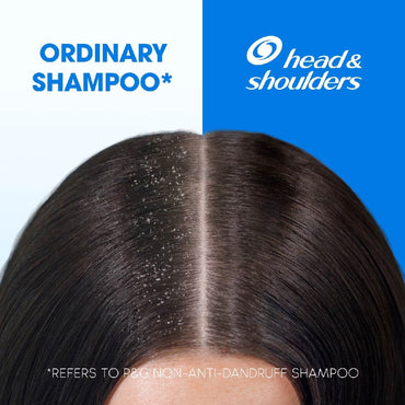 H&S Shampoo Itchy Scalp 720Ml